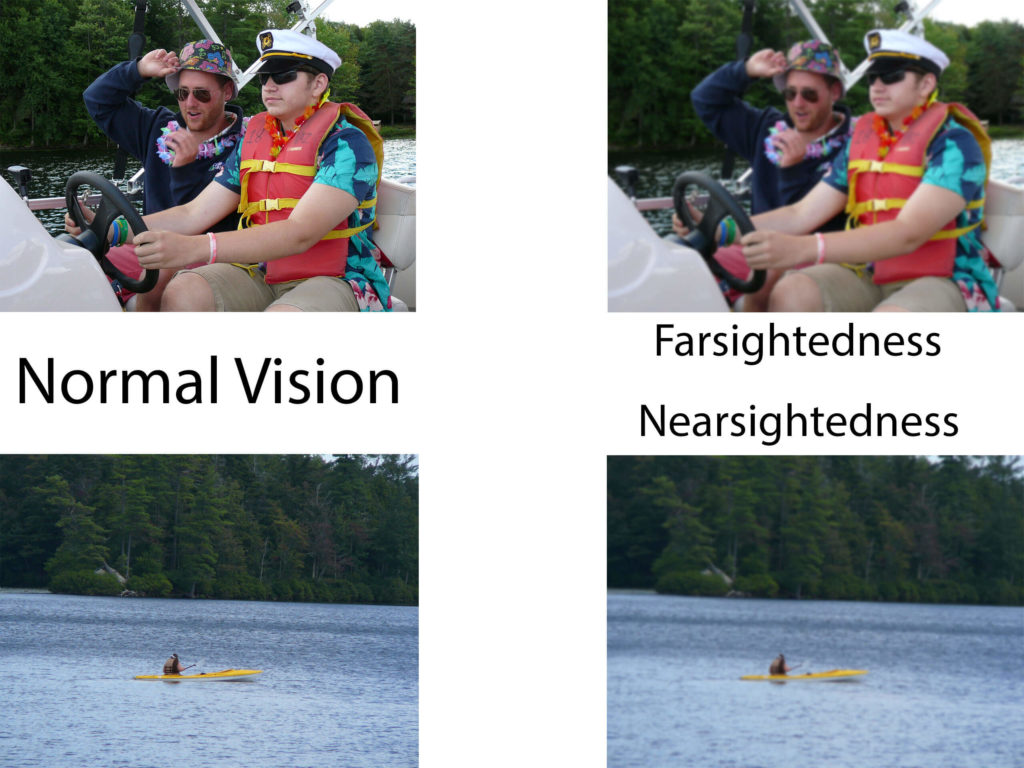 Comparison of normal vision and farsightedness and nearsightedness.